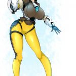 1085083 Tracer breast expansion 1