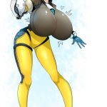 1085083 Tracer breast expansion 2