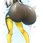1085083 Tracer breast expansion 3