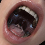 7406803 plaatsen prelude to vore v by flagg3d db4418i